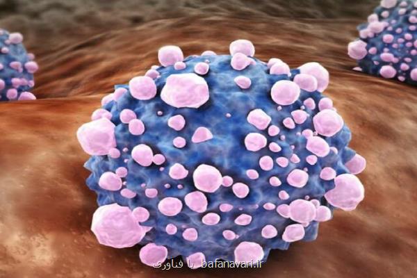 کشف عاملی که به متاستاز سرطان پانکراس منجر می شود