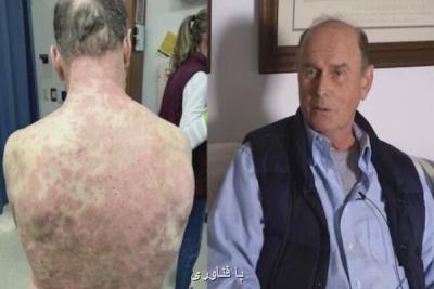 تزریق واكسن جانسون و جانسون مرد 74 را به بیمارستان كشاند