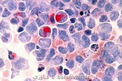 ابداع یك روش موثر برای درمان سرطان خون