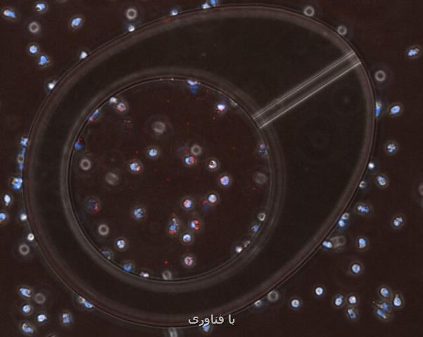 کشف راهی برای افزایش توانایی آنتی بیوتیک ها در مقابل باکتری های مقاوم