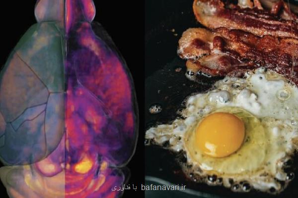 رژیم غذایی پرچرب مغز را کوچک می کند