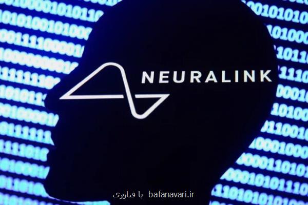 نورالینک پیشرفت ایمپلنت مغزی خویش را در آبان ماه اعلام می کند
