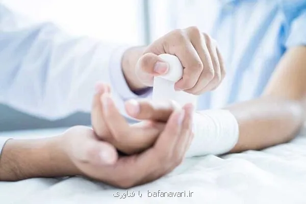 نوآوری ایرانی در ترمیم زخم و صرفه جویی ۱۵ و دو دهم میلیون دلاری ارزی