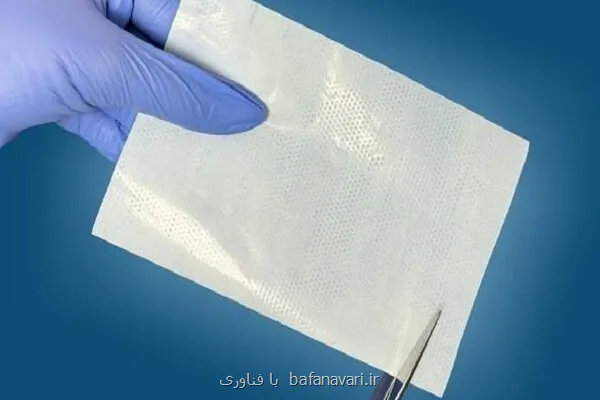 درمان زخم با زخم پوش فوق نازک هوشمند و صرفه جویی یک میلیون دلاری