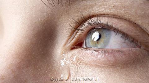 شناسایی بیماری های چشمی با حسگر تغییر رنگ