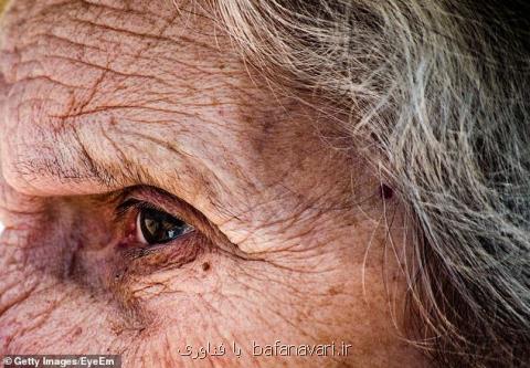 پیش بینی سن افراد با بررسی گوشه چشم آنها