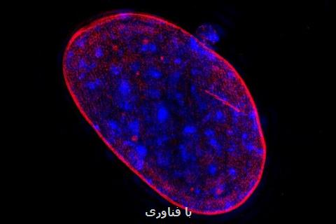 تشخیص ساده تر سرطان با بررسی كروموزوم ها