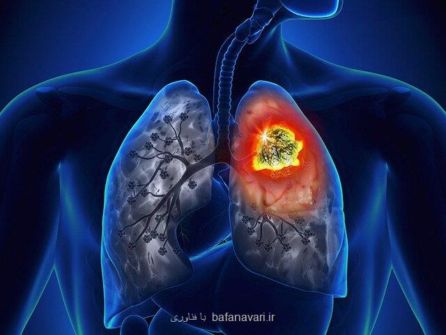 كاهش مرگ ومیر ناشی از سرطان ریه با مدلهای جدید پیش بینی