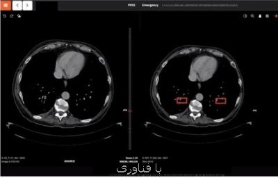 طراحی سامانه هوشمند تشخیص كرونا در پارك فناوری اردبیل