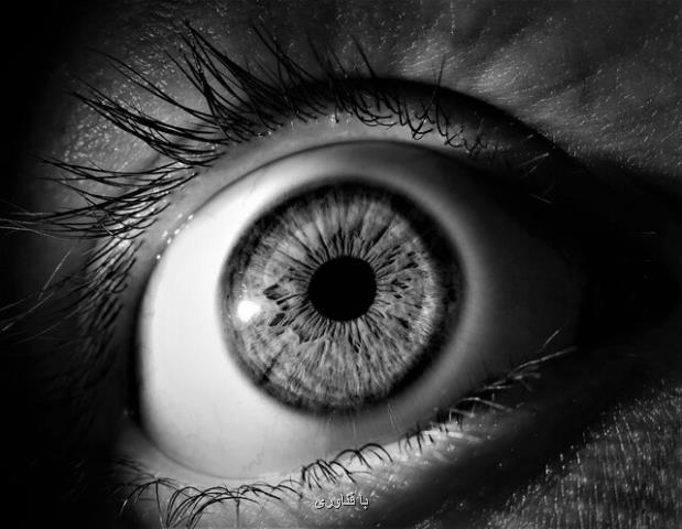 روش جدید ژن درمانی برای درمان یك بیماری چشمی